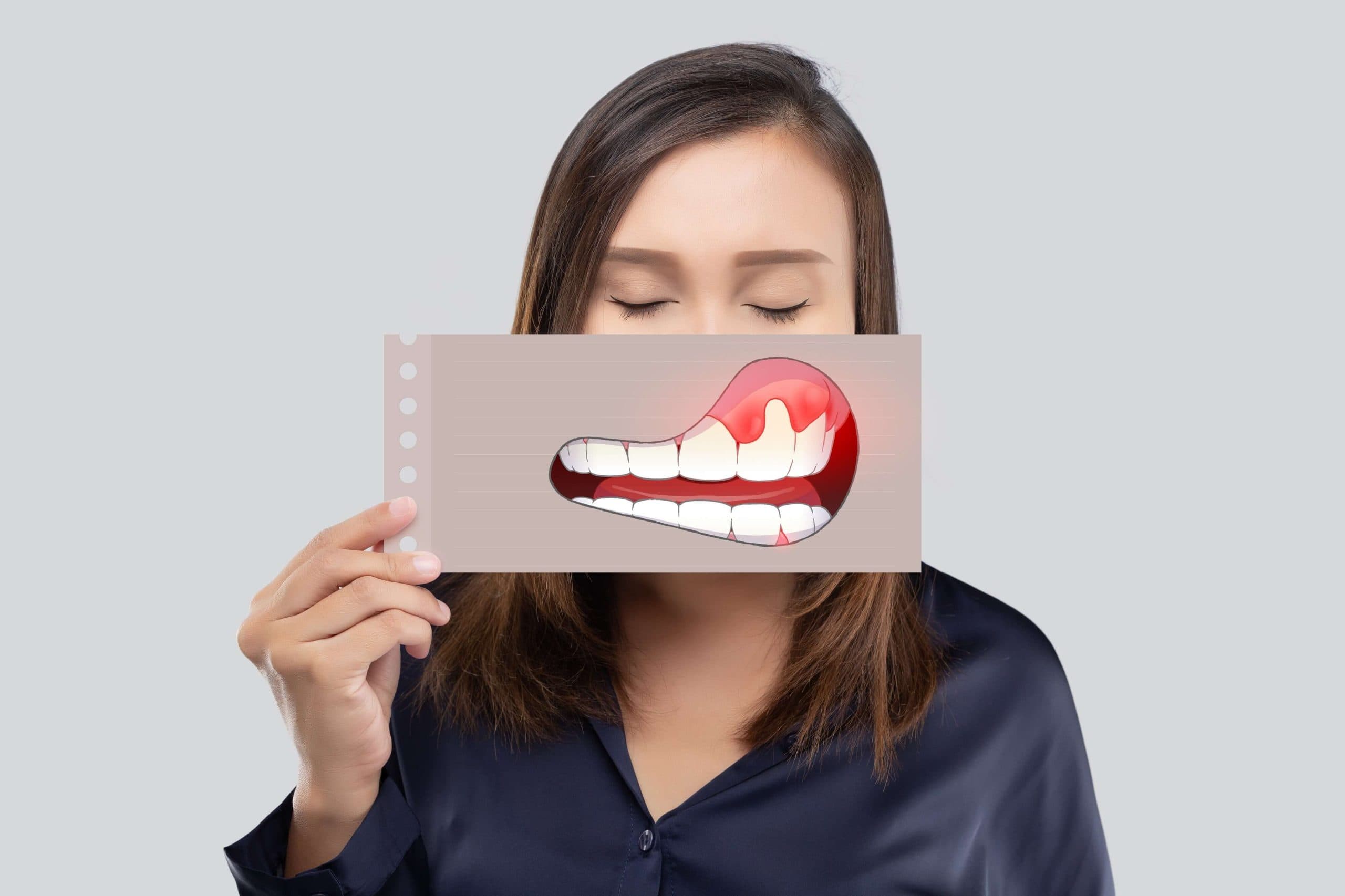 Bleeding Gum Symptoms: Warning Signs You Shouldn't Ignore