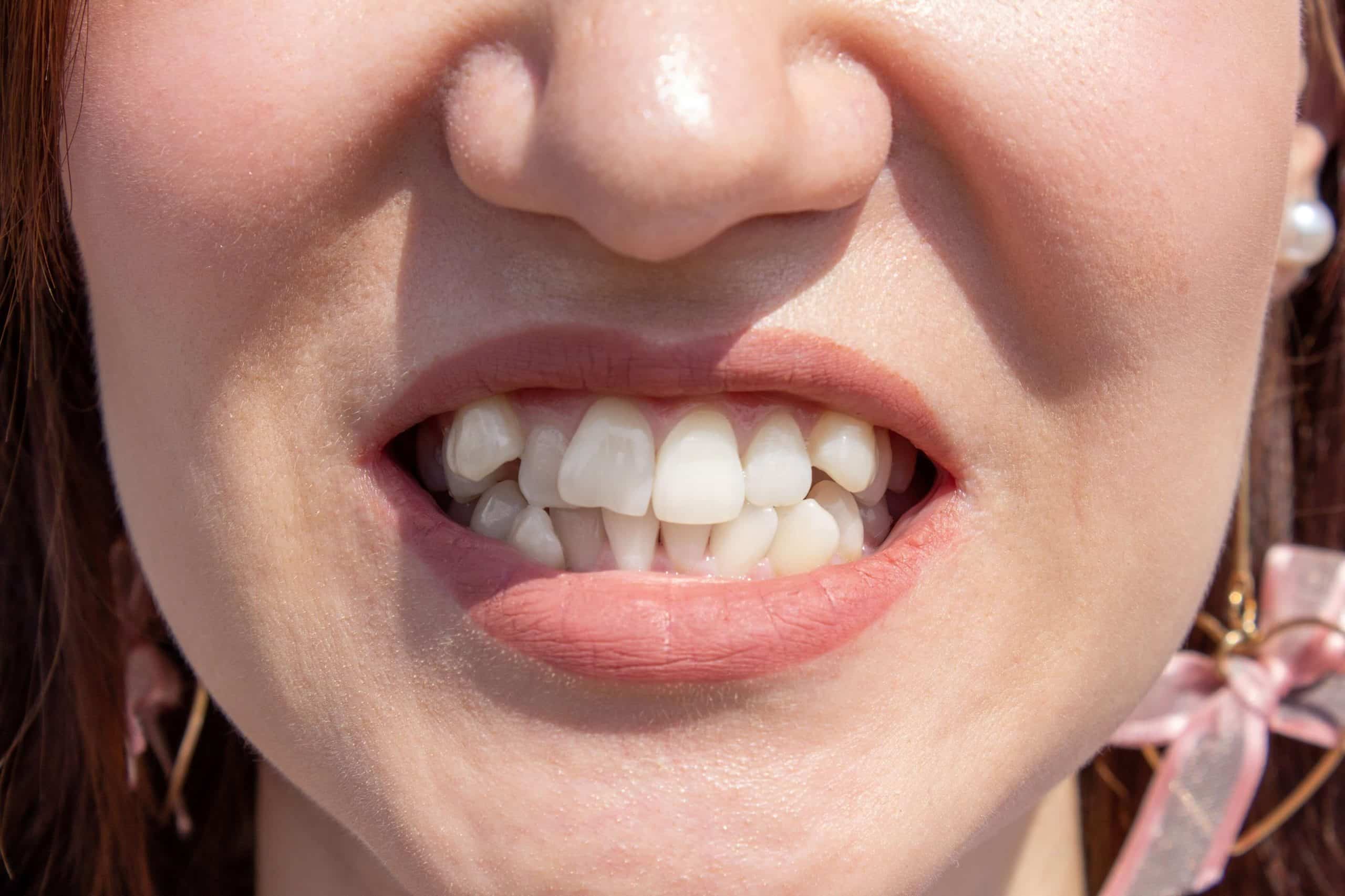 Best Treatment for Periodontal Disease: A Complete Guide