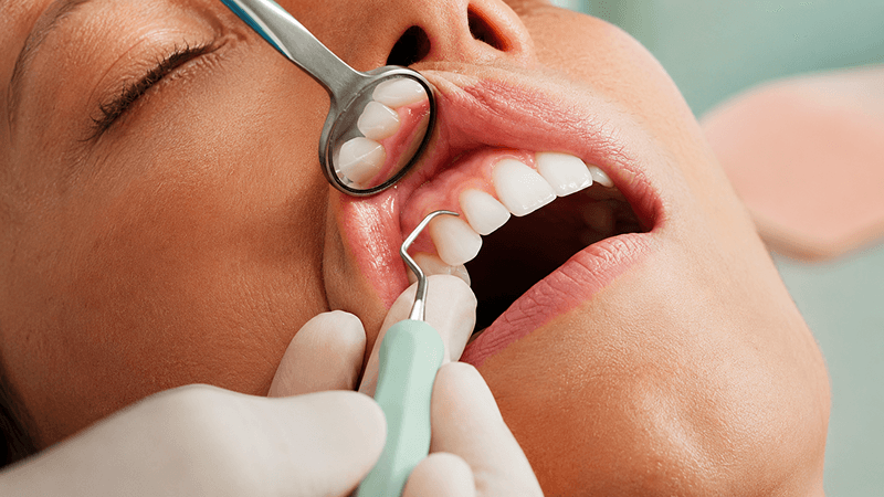 Gum treatments