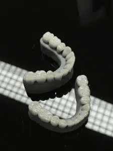 A chrome partial denture arch showing the metal framework