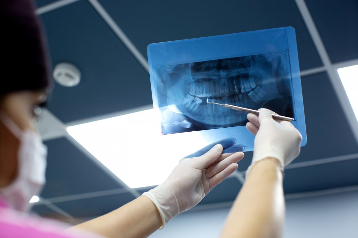A dentist holds up a dental X-ray to a ceiling light inside a clinic and points at it with a dental explorer.