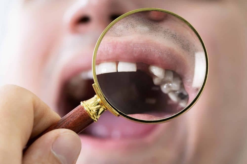 A dentist examining a patient's teeth for signs of a loose tooth