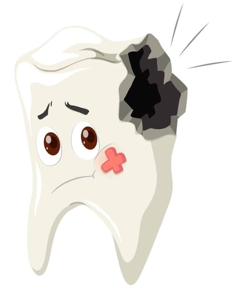 When to See a Dentist for a Chipped Front Tooth
