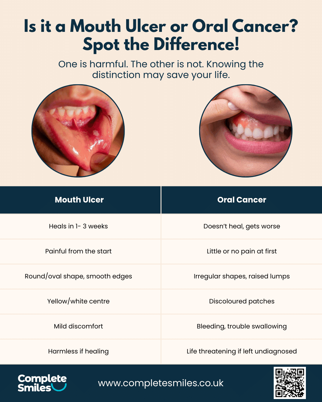 Key Differences: When is it Just an Ulcer and When is it Oral Cancer