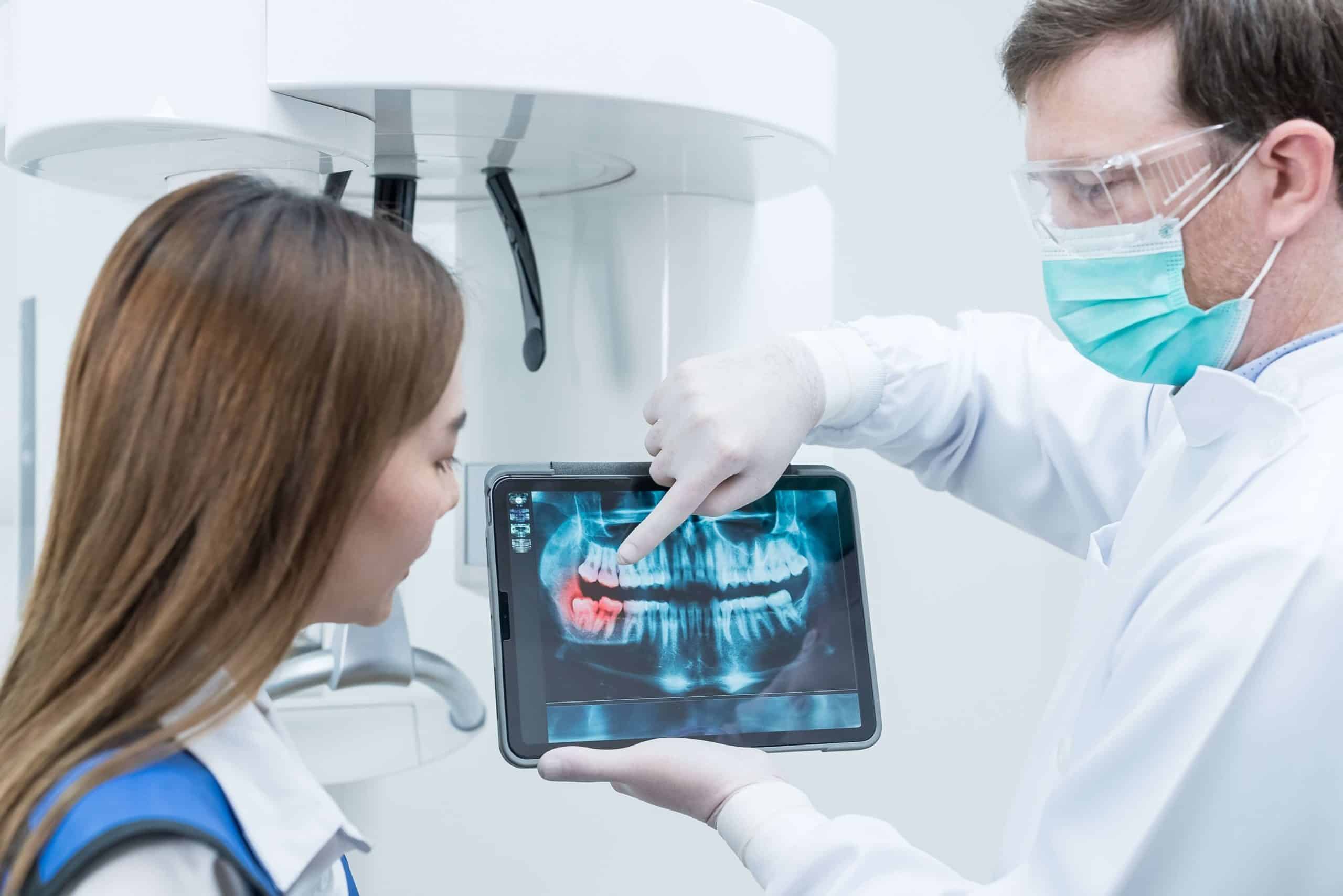 Signs of mouth ulcers