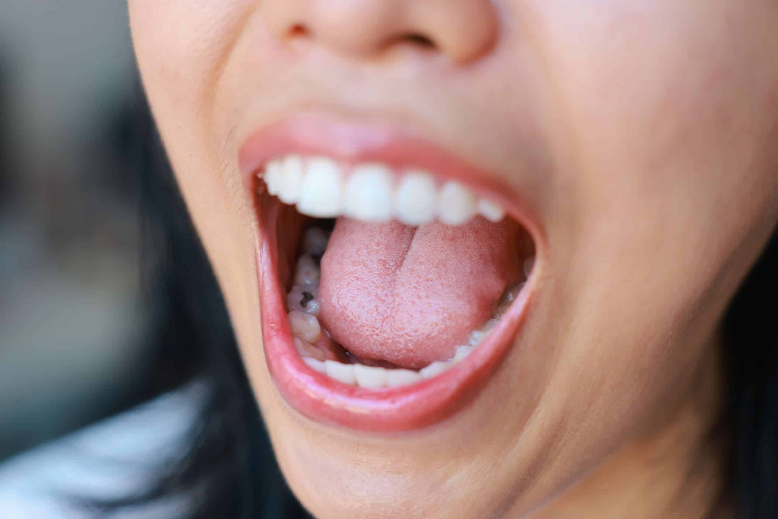Person experiencing metallic taste in mouth