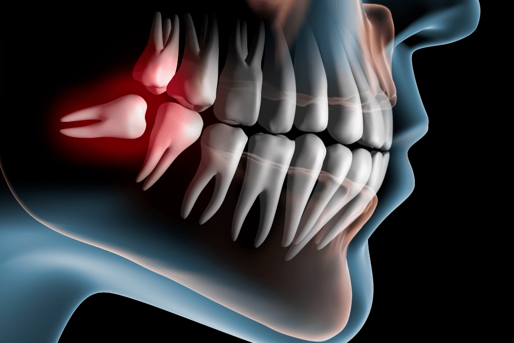 Person holding jaw in pain