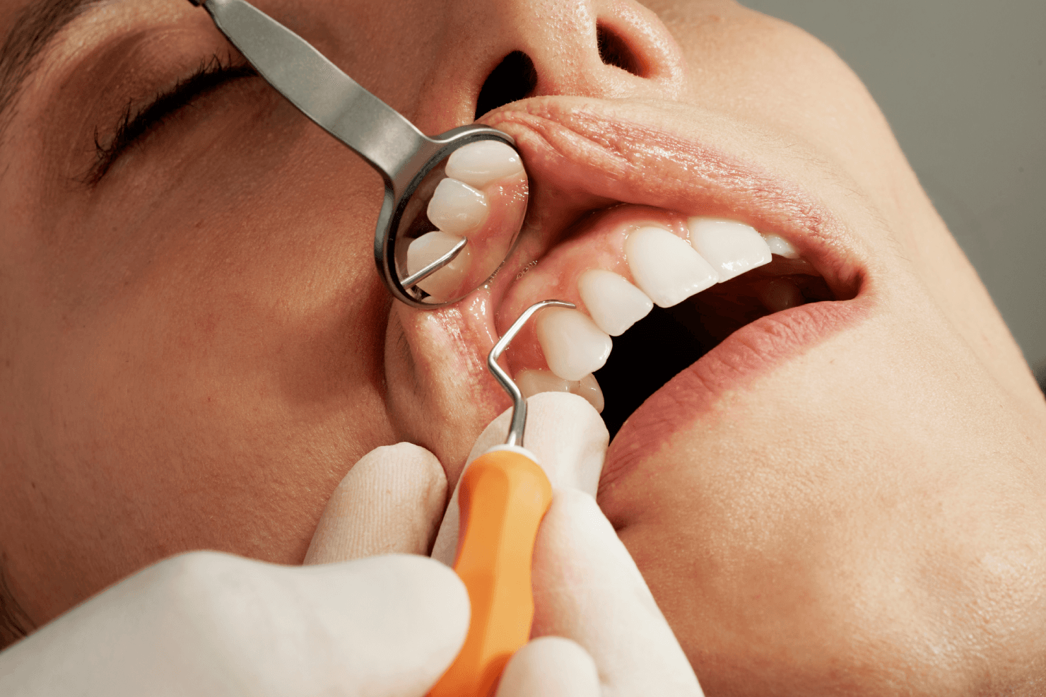 5 Hidden Gum Disease Symptoms People Often Ignore