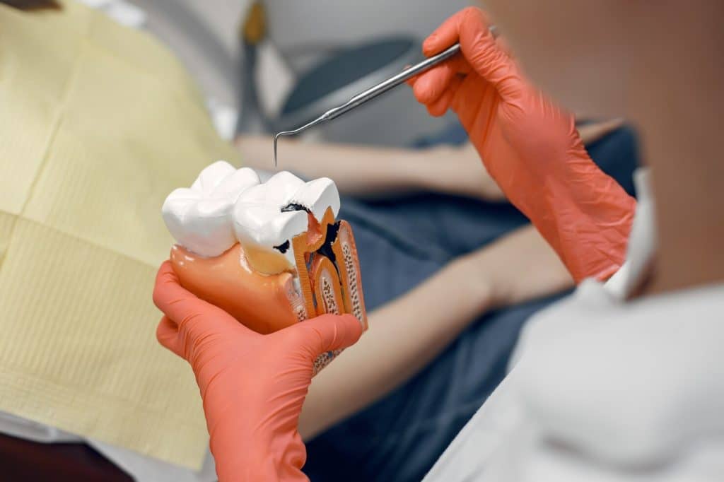 How Much Does It Cost To Fix A Cracked Tooth?
