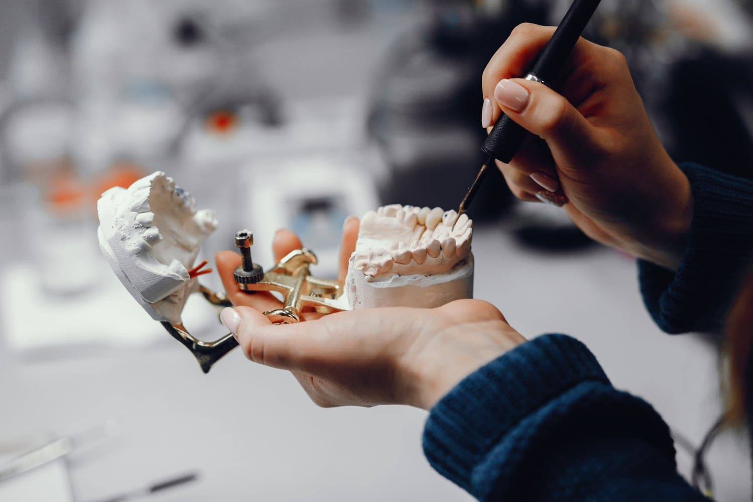 How Much Do Dental Implants Cost in London in 2025?