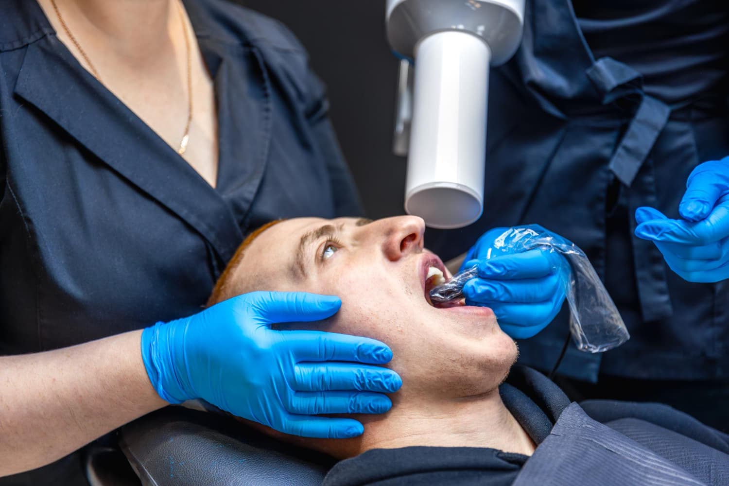 What Are All-On-4 Dental Implants and What Do You Need to Know Before Choosing Them?
