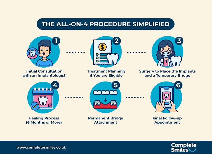 Infographic about the All-on-4 dental implants procedure.
