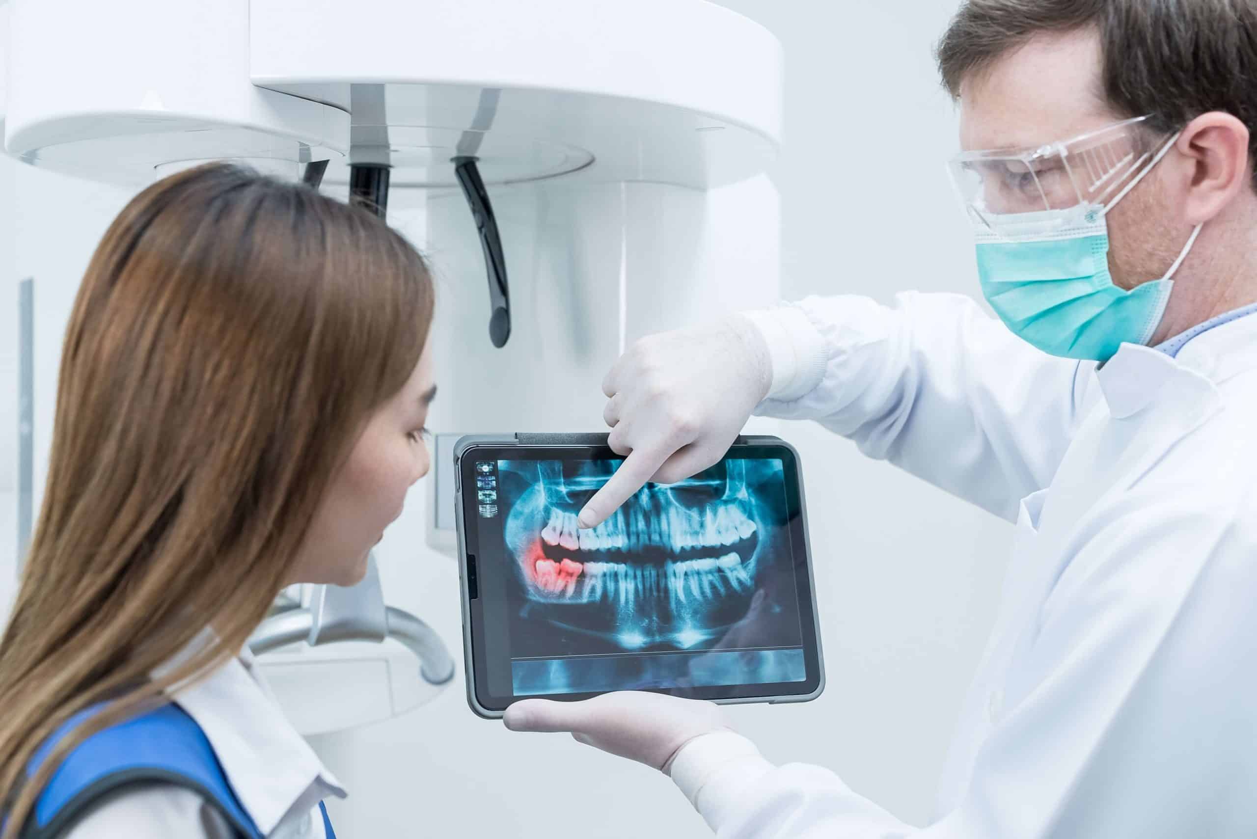 What is an Impacted Wisdom Tooth? Signs & Treatment