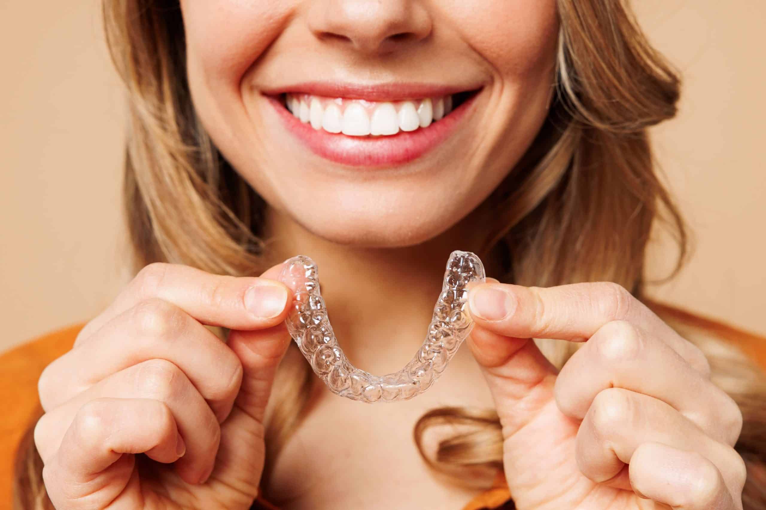 Before and after comparison of crowded teeth treatment