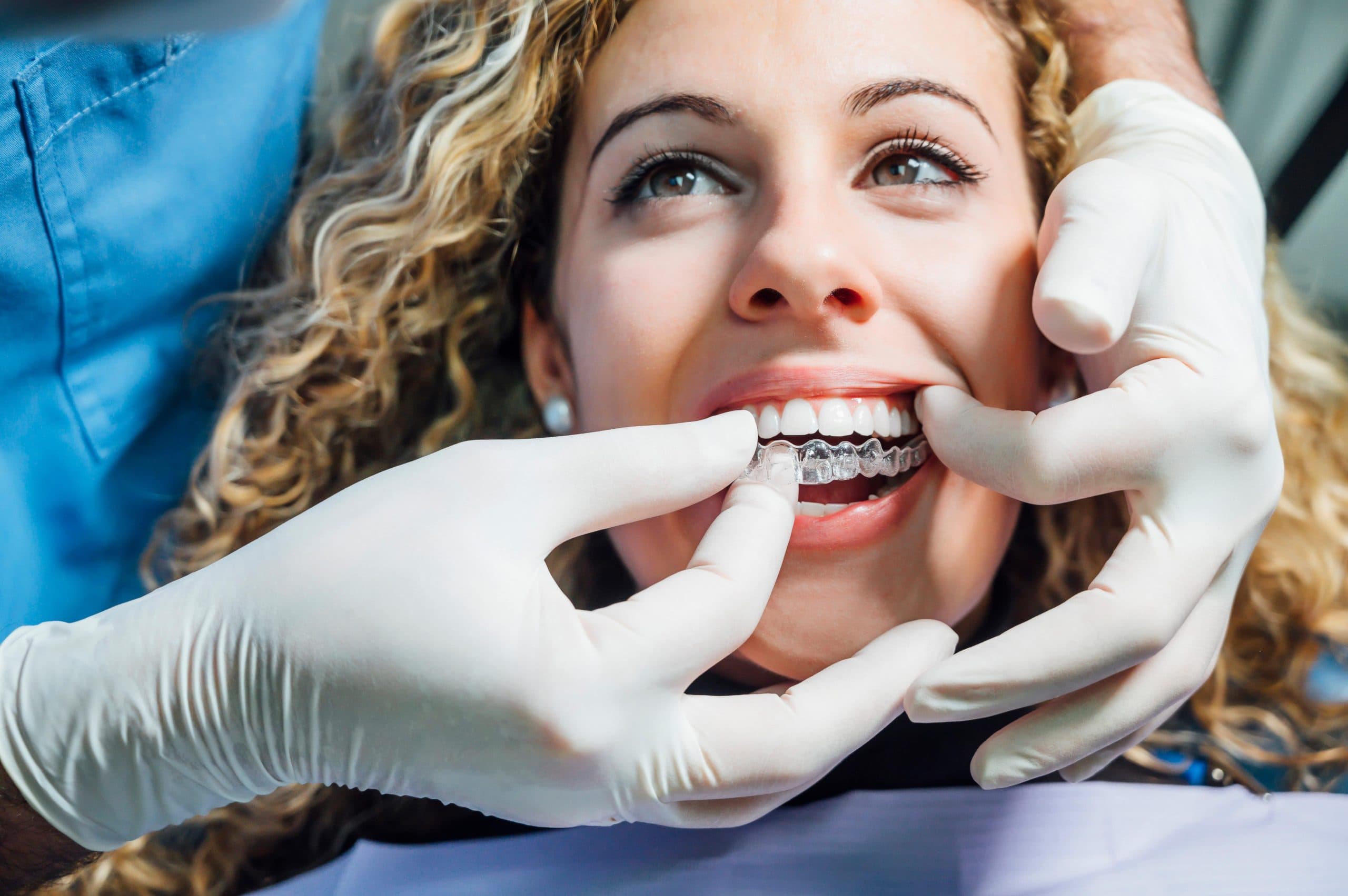Clear Invisalign aligners next to a dental model