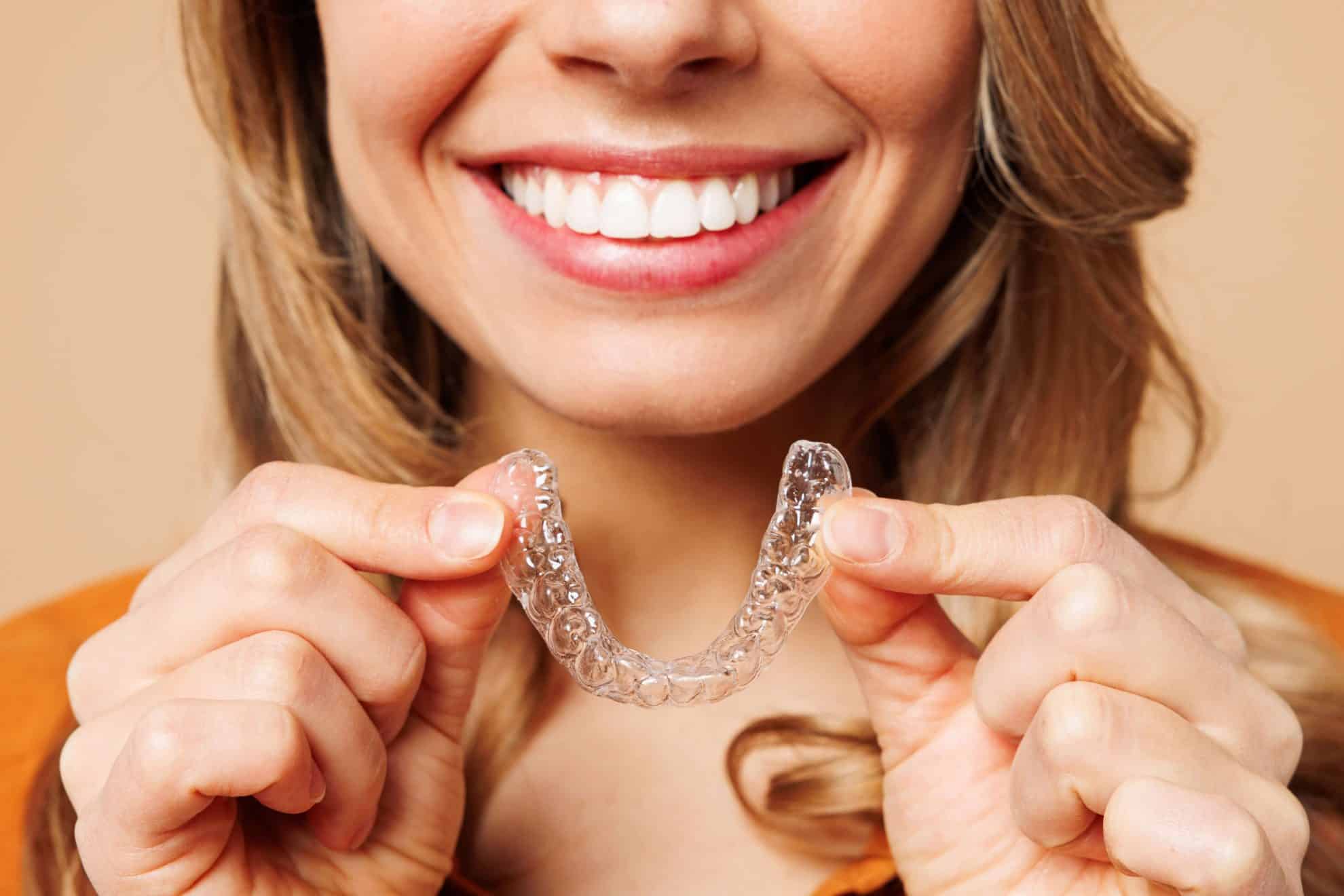 Clear Invisalign aligners showing the straightening process